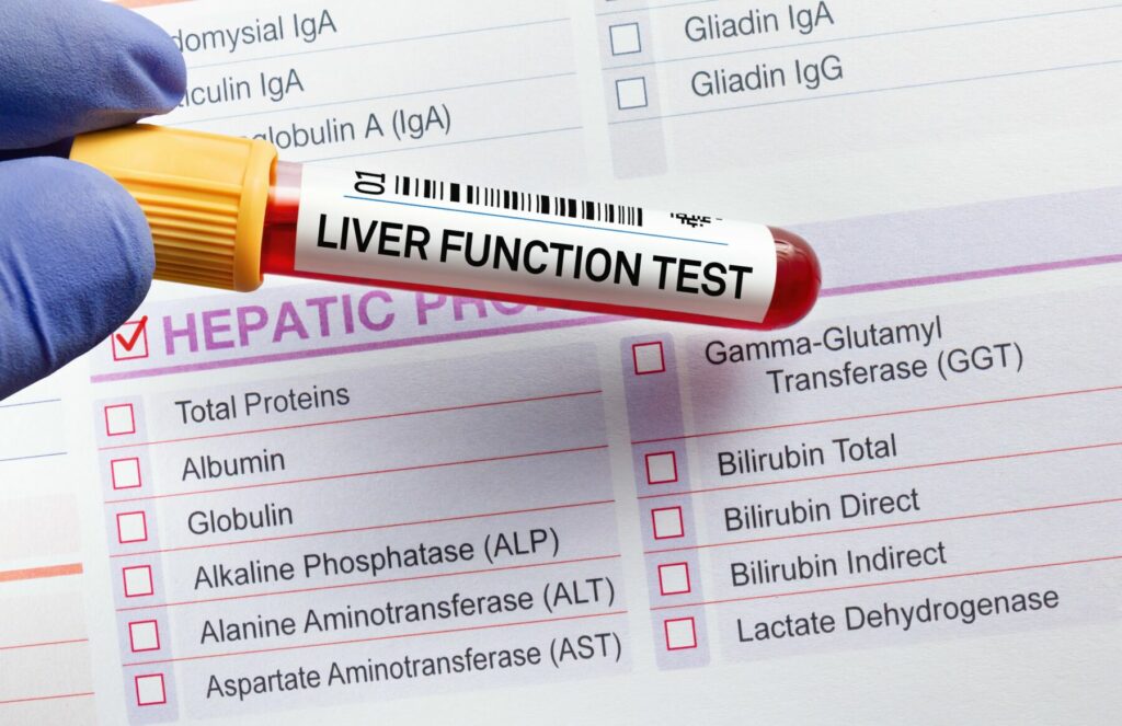 Liver Function Test During Pregnancy: Is It Safe?