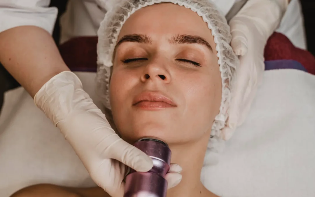 Microneedling Treatment