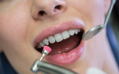 Care Tips for Maintaining Platinum Dental Fixtures