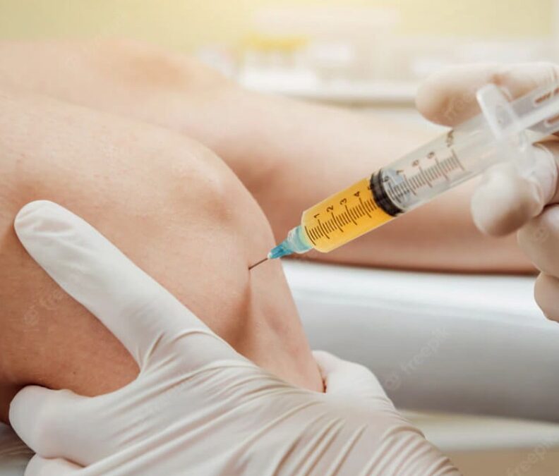 Better Knee Movement with PRP Therapy