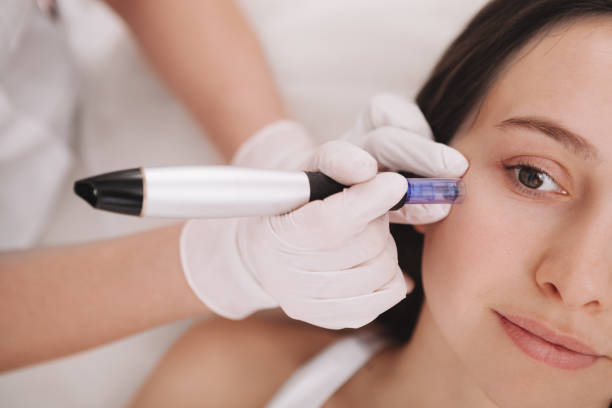 Can Dermapen Microneedling reduce redness