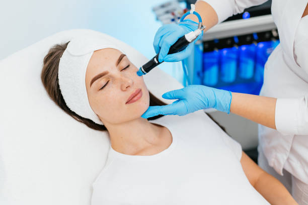 Can HydraFacial Remove Dead Skin Cells Fast