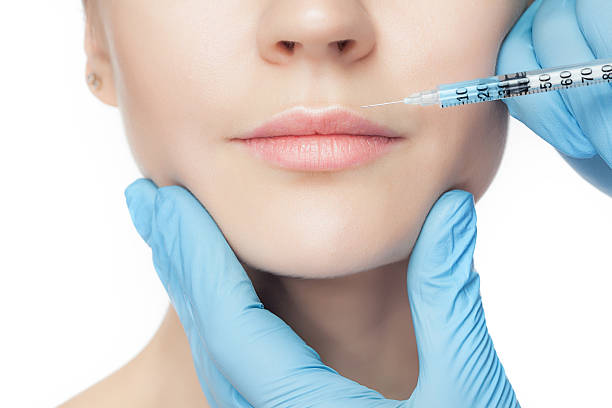 Can Lip Fillers Injection Improve Lip Contours