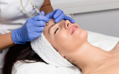 How Effective Is RF Micro Needling Today?