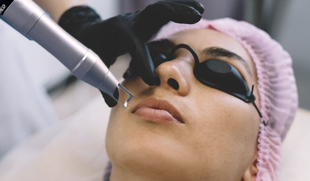 Is Pico Laser Treatment Good for Sensitive Skin