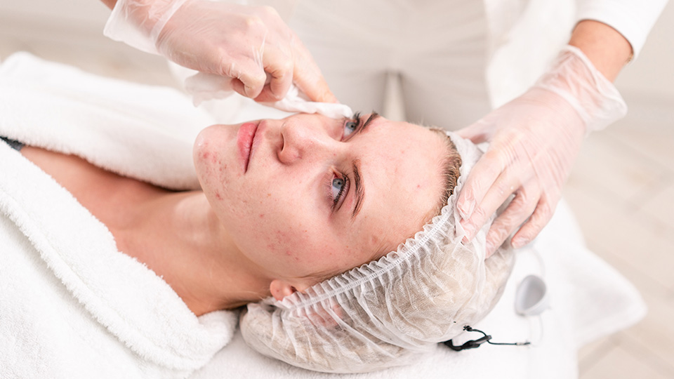 What Acne Treatment Works Overnight Fast