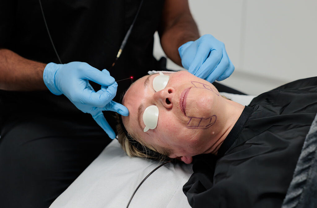 What Are the Benefits of Choosing EndoLift