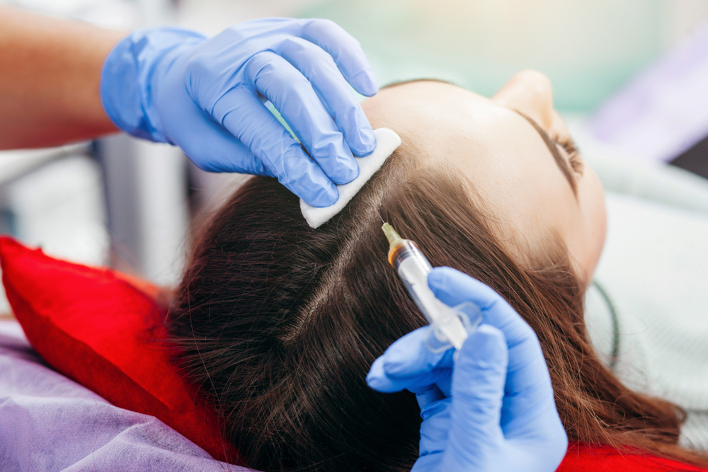 Best PRP Hair Treatment in Abu Dhabi