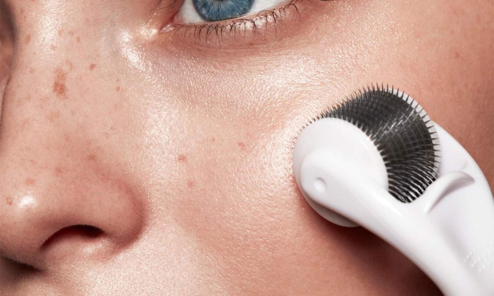 What Is Derma Roller Treatment and How It Works?
