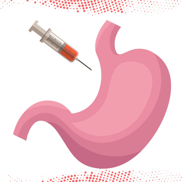 What Makes Gastric Botox So Popular Now
