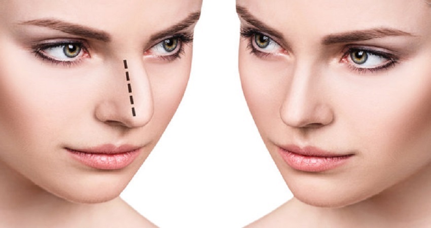 اختصر طريق الجمال بتجميل الأنف في دبي