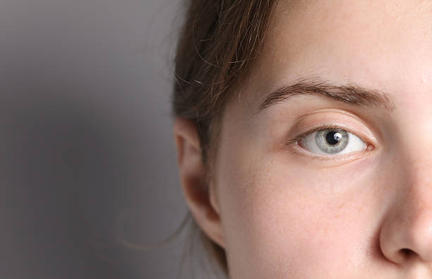 Can Eye Bag Removal Improve Self Esteem