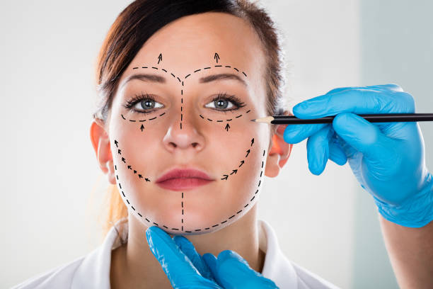 Can Facelifts Help Achieve a Youthful Appearance