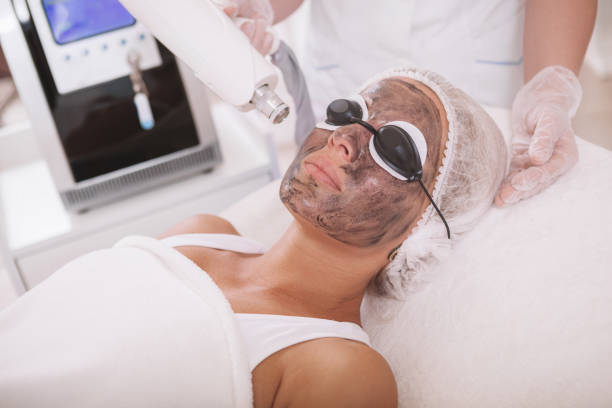 Can Laser Carbon Peel Improve Skin Elasticity