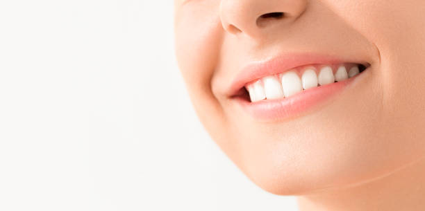 Can Teeth Whitening Improve Smile Appearance