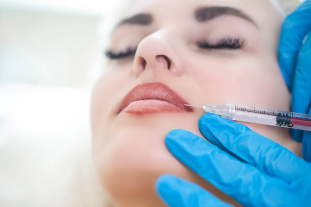 Can lip filler Help You Achieve Balanced Features