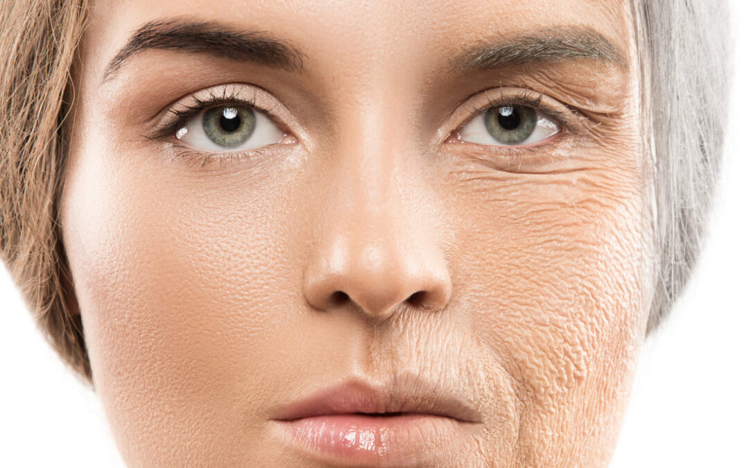 How Fine Lines and Wrinkle Removal Refreshes Skin