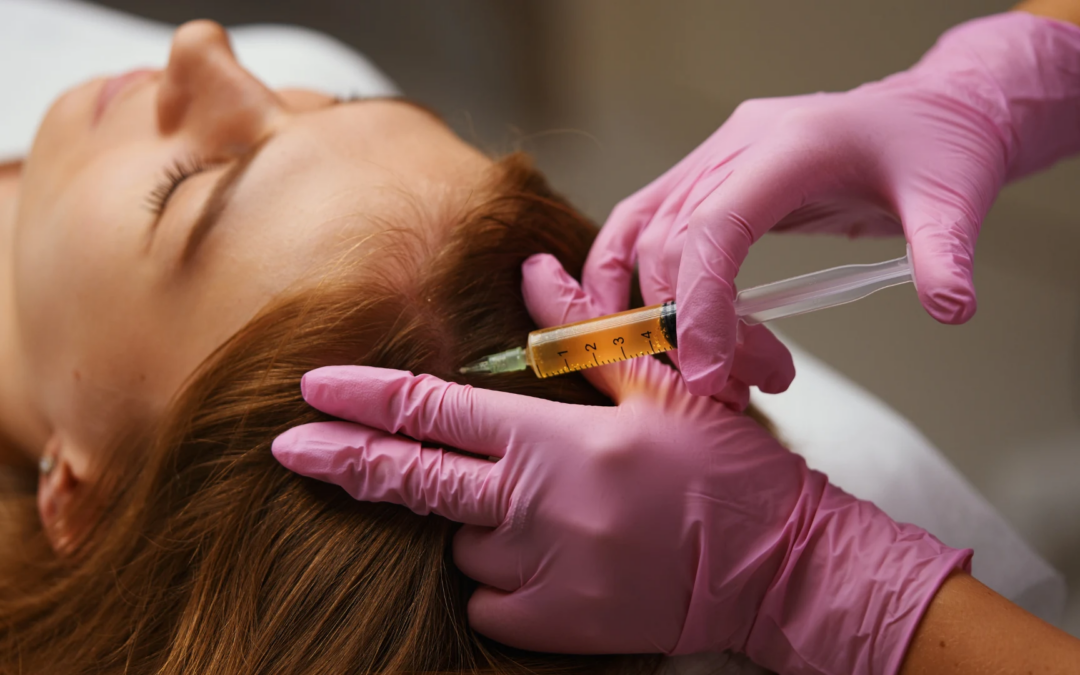 How PRP Treatment Enhances Hair Growth