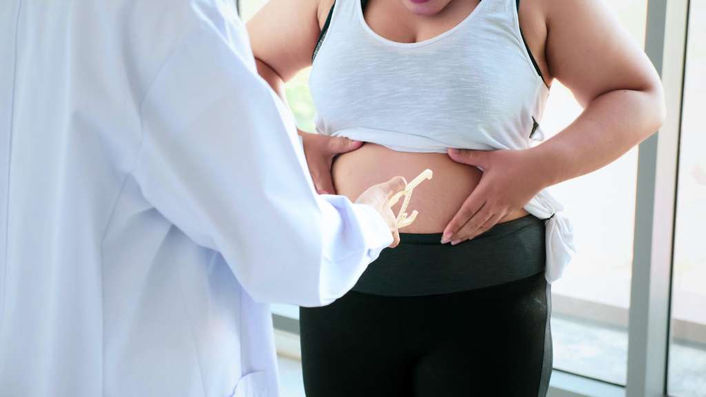 What Are the Benefits of Mini Gastric Bypass