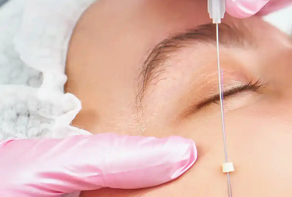 What to Avoid After Sugar Thread Lift