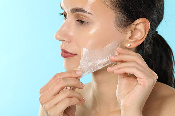 Are Chemical Peels Suitable for Oily Skin Types