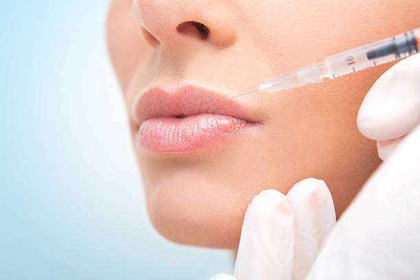 Are Russian Lip Fillers Ideal for Mature Lips