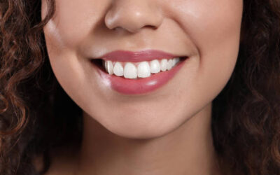 Can Teeth Whitening Fix Stubborn Tooth Discoloration?