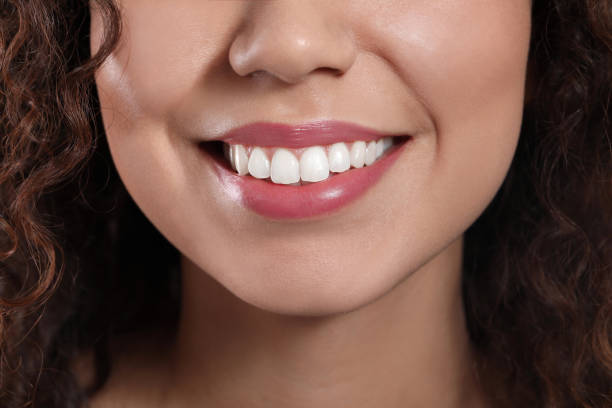 Can Teeth Whitening Fix Stubborn Tooth Discoloration?