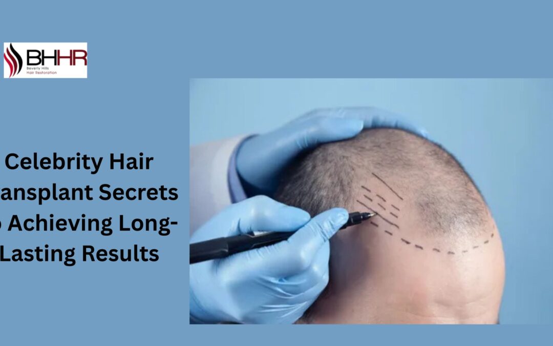Celebrity Hair Transplant Secrets to Achieving Long-Lasting Results