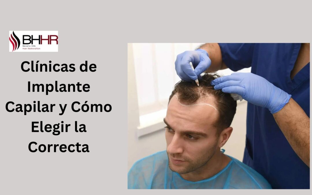 clinicas de implante capilar