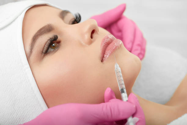 Does Lip Fillers Injection Help Aging Lips Look Younger?
