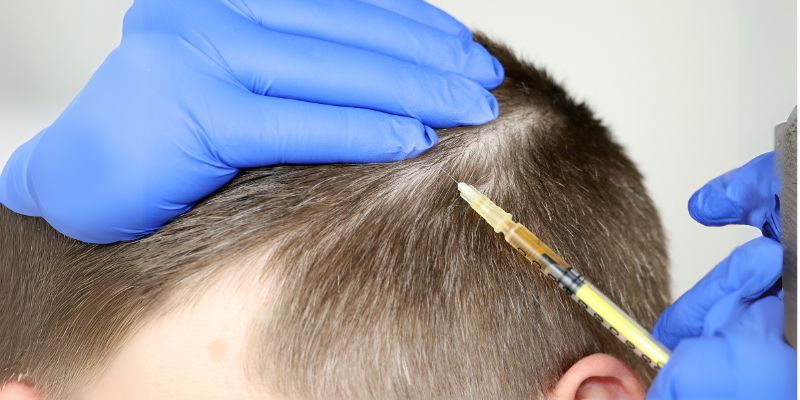 Does Stem Cell Hair Transplant Enhance Hair Density?