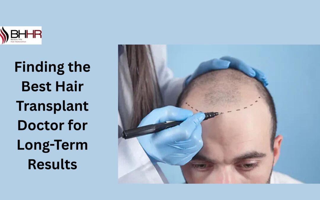 Finding the Best Hair Transplant Doctor for Long-Term Results