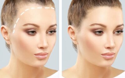 أفضل تقنيات زراعة الشعر في عيادة تجميل بدبي