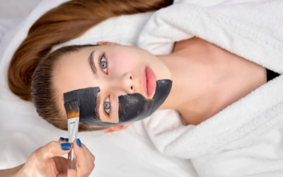 Is Laser Carbon Peel Good Before Events?