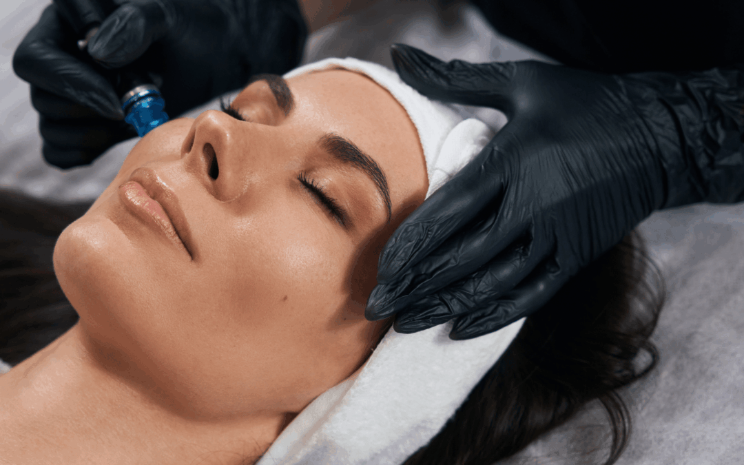 Top 5 Reasons to Choose Hydrafacial