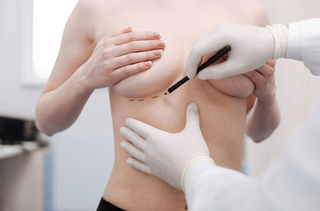 What Can You Expect After Breast Lift Surgery?