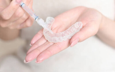 Teeth Whitening in Riyadh Using Contemporary Dental Methods