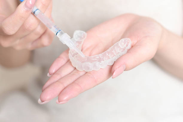 Teeth Whitening in Riyadh Using Contemporary Dental Methods