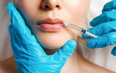 Are Russian Lip Fillers Good for Mature Lips?