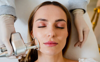 Can CO2 Laser Remove Stretch Marks Effectively?