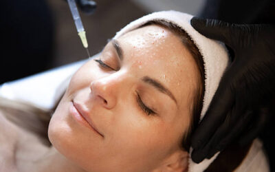 Can Cheek Fillers Injections Fix Hollow Cheeks?