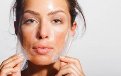 Can Chemical Peel Reduce Acne Breakouts Fast?