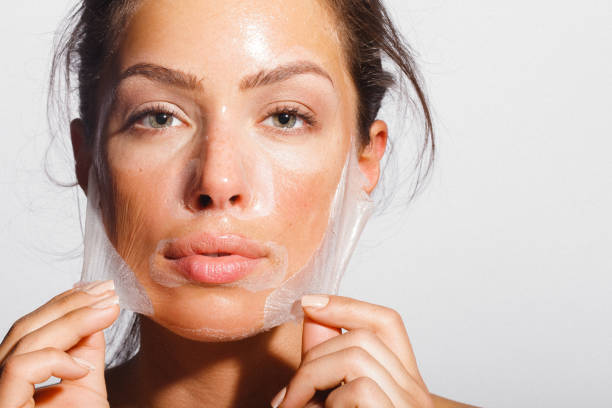 Can Chemical Peel Reduce Acne Breakouts Fast