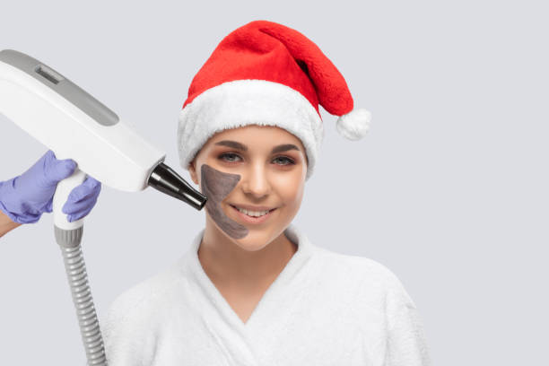 Can Laser Carbon Peeling Fade Acne Marks