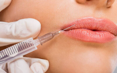 Can Lip Fillers Injection Define Your Lip Borders?