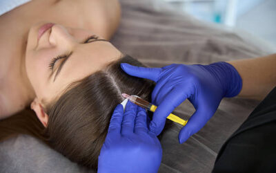 Can Mesotherapy Help with Hair Volume Loss?
