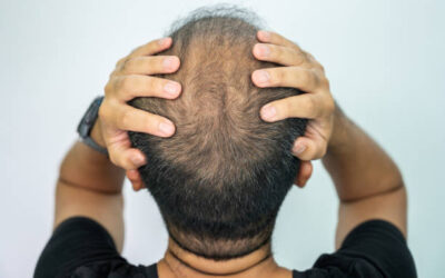Does GFC Treatment for Hair Improve Hair Growth?