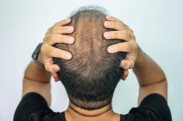 Does GFC Treatment for Hair Improve Hair Growth