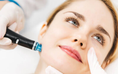 Does HydraFacial Help with Sun-Damaged Skin?